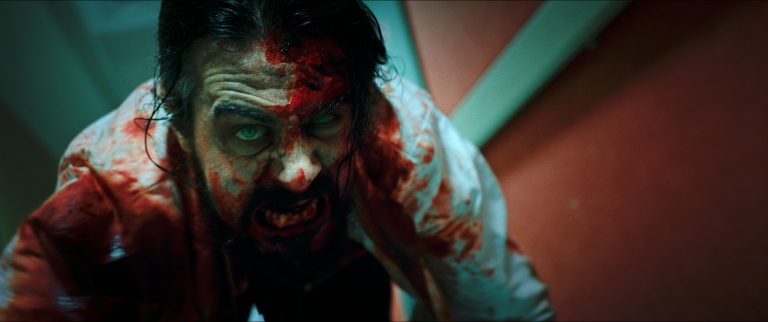 RLJE Films To Release Shudder’s Zombie Thriller ‘Yummy’ On Blu-Ray This October