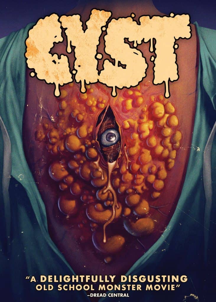 Cyst Cover Art
