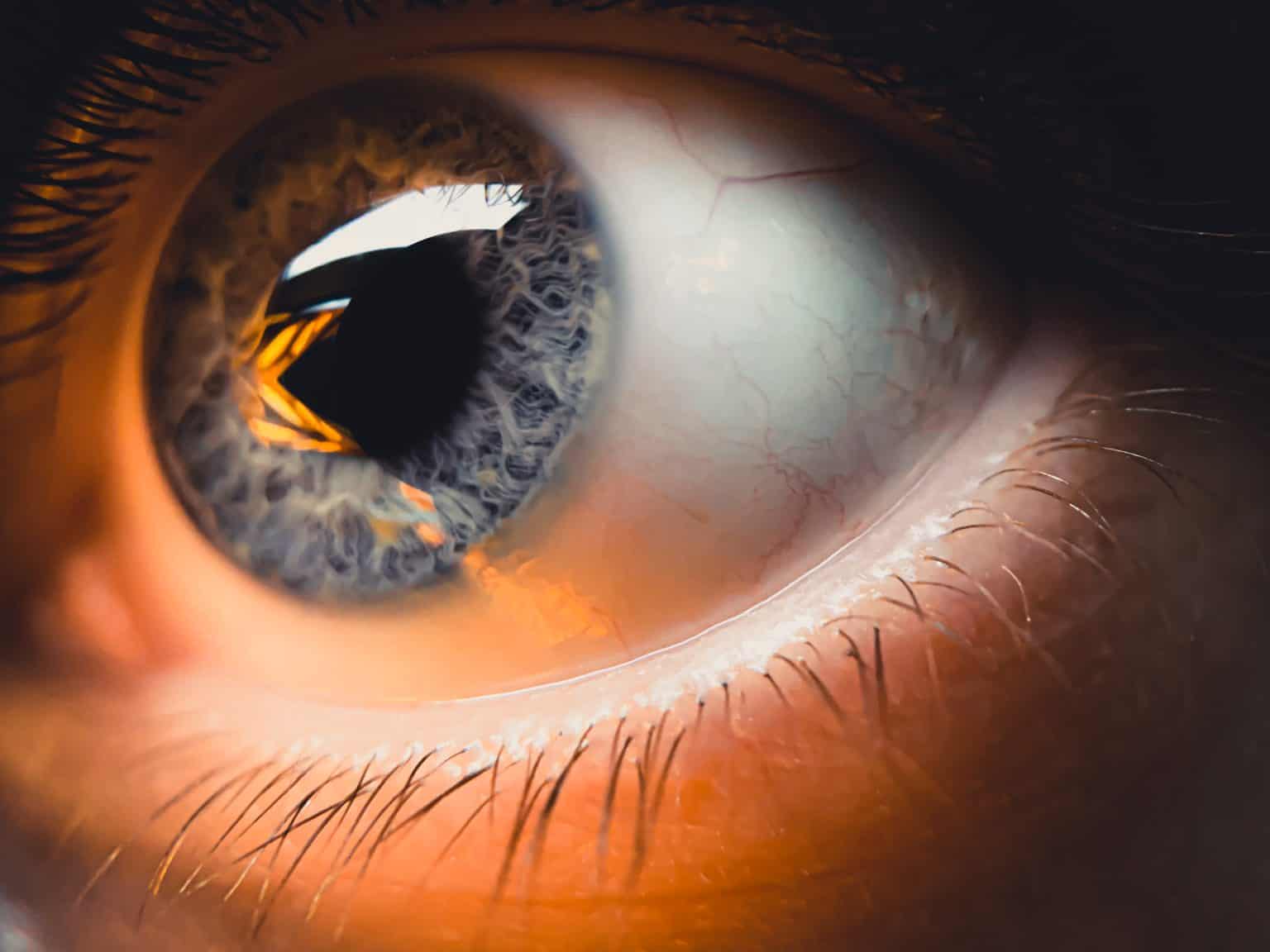 Gamers And Contact Lenses: All You Need To Know
