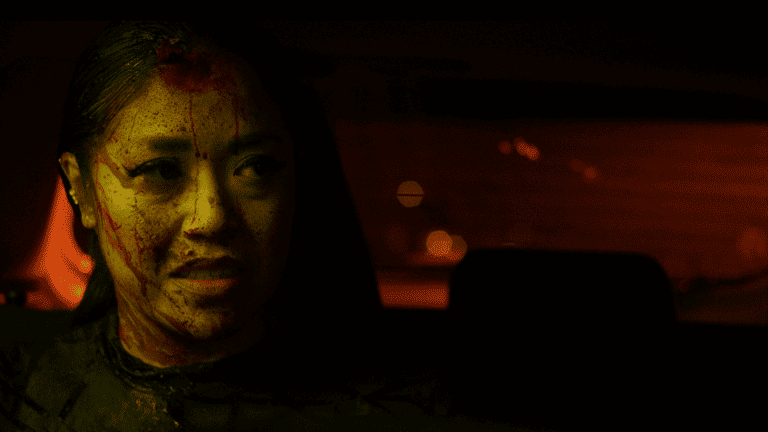 A woman in a car with blood on her face.