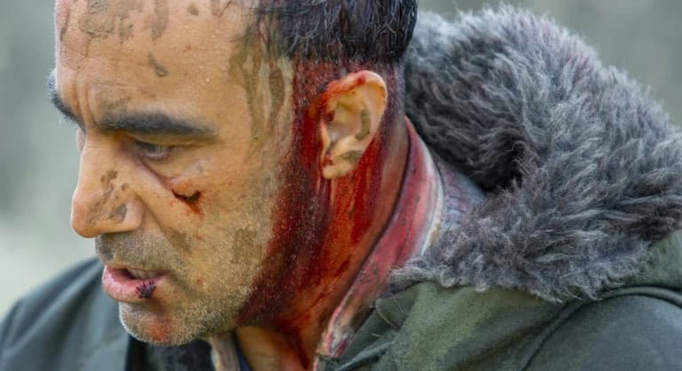 A man with blood on his face and ear, appearing distressed or injured.