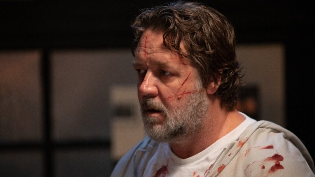 A bearded man with a concerned expression has scratches on his face and is wearing a bloodstained white shirt.