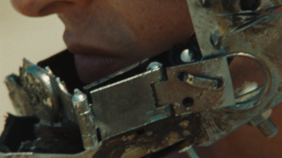 Close-up of an individual with a complex metallic contraption around their jaw and mouth.