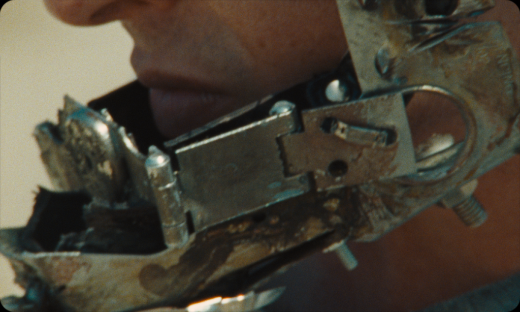 Close-up of a person's lower face wearing a metallic, mechanical device attached around their jaw and chin.