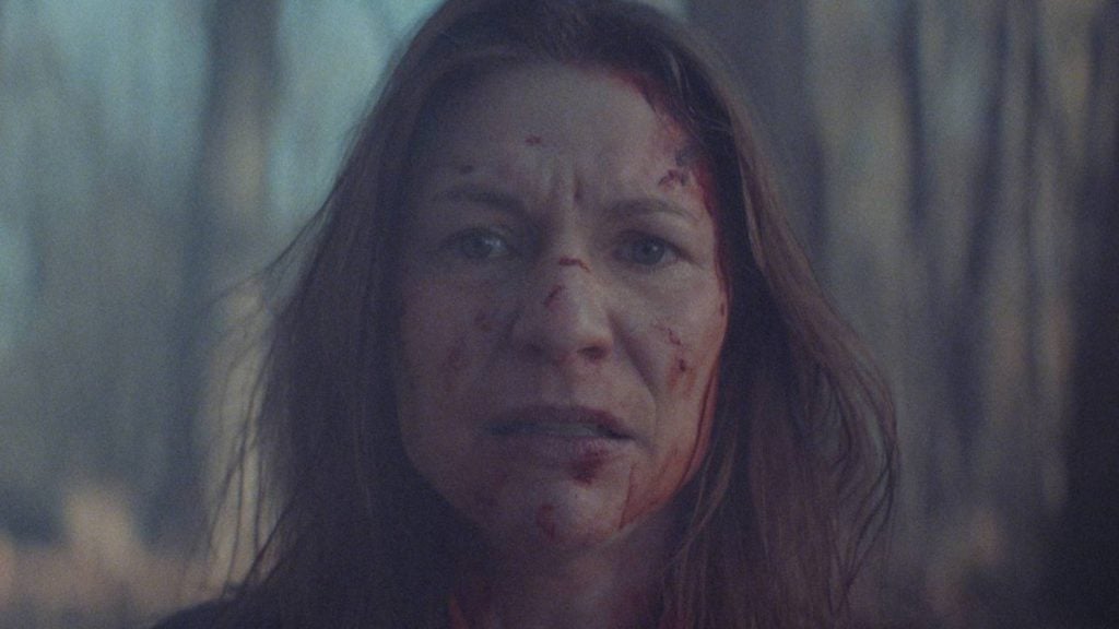 A woman with long hair stands outdoors, her face smeared with blood and minor cuts, looking directly at the camera with a serious expression.