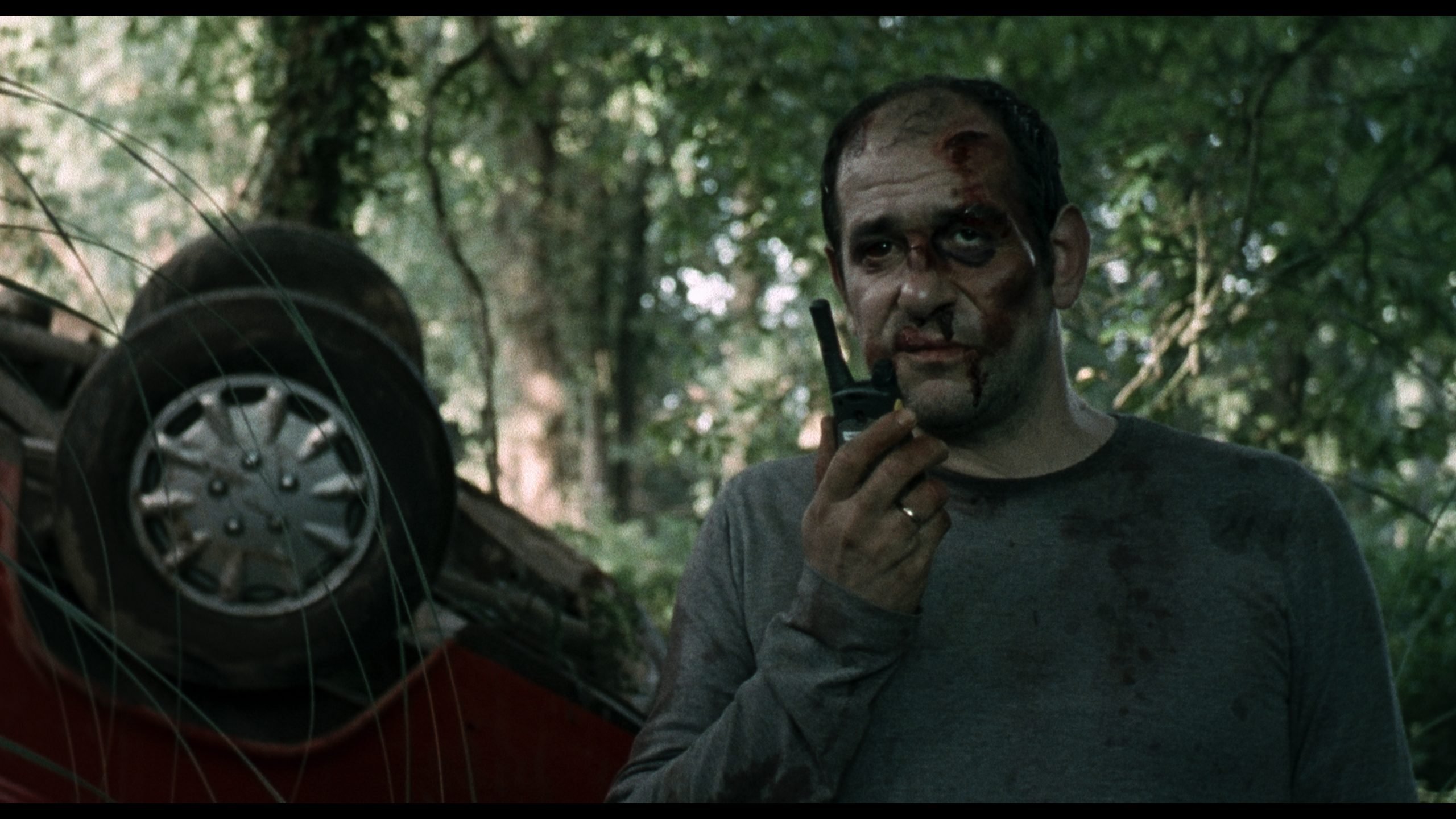 A man with a bruised and bloodied face holds a walkie-talkie, standing in front of an overturned car in a forest.