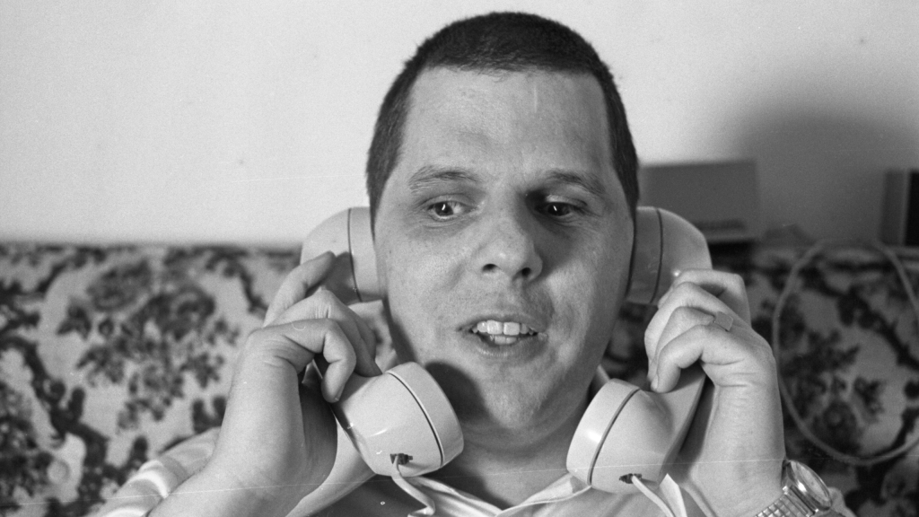 A man sits on a patterned couch, holding two telephone receivers to his ears, looking slightly to the side.