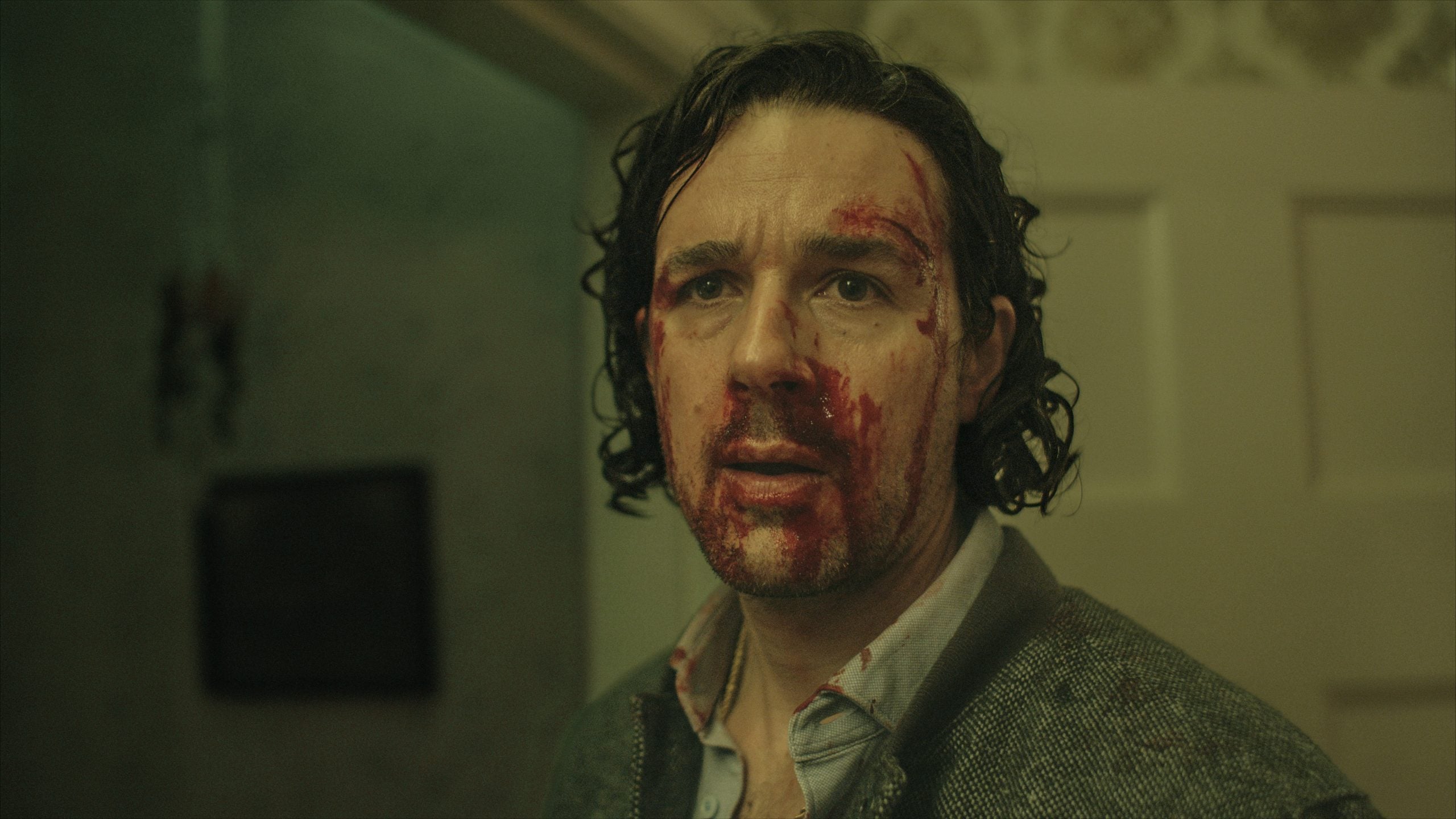 A man with bloody injuries on his face and mouth stands in front of a partially open door, looking forward with a distressed expression.